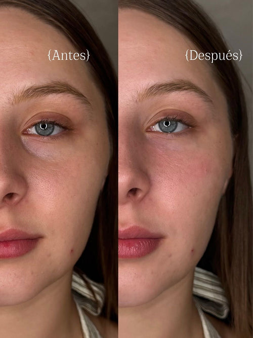 Smoshes™ Retinal Shot 0.1% Anti-edad Clinico + 1 GRATIS