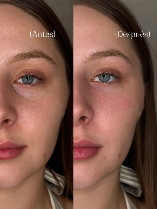 Smoshes™ Retinal Shot 0.1% Anti-edad Clinico + 1 GRATIS