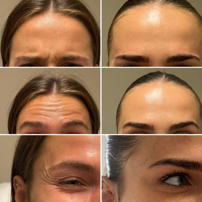 Smoshes™ Retinal Shot 0.1% Anti-edad Clinico + 1 GRATIS