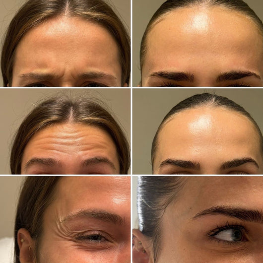 Smoshes™ Retinal Shot 0.1% Anti-edad Clinico + 1 GRATIS